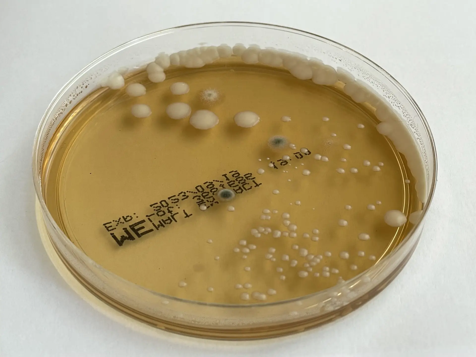 Mikrobiologische Analyse - Bakterienkolonien auf Nährboden